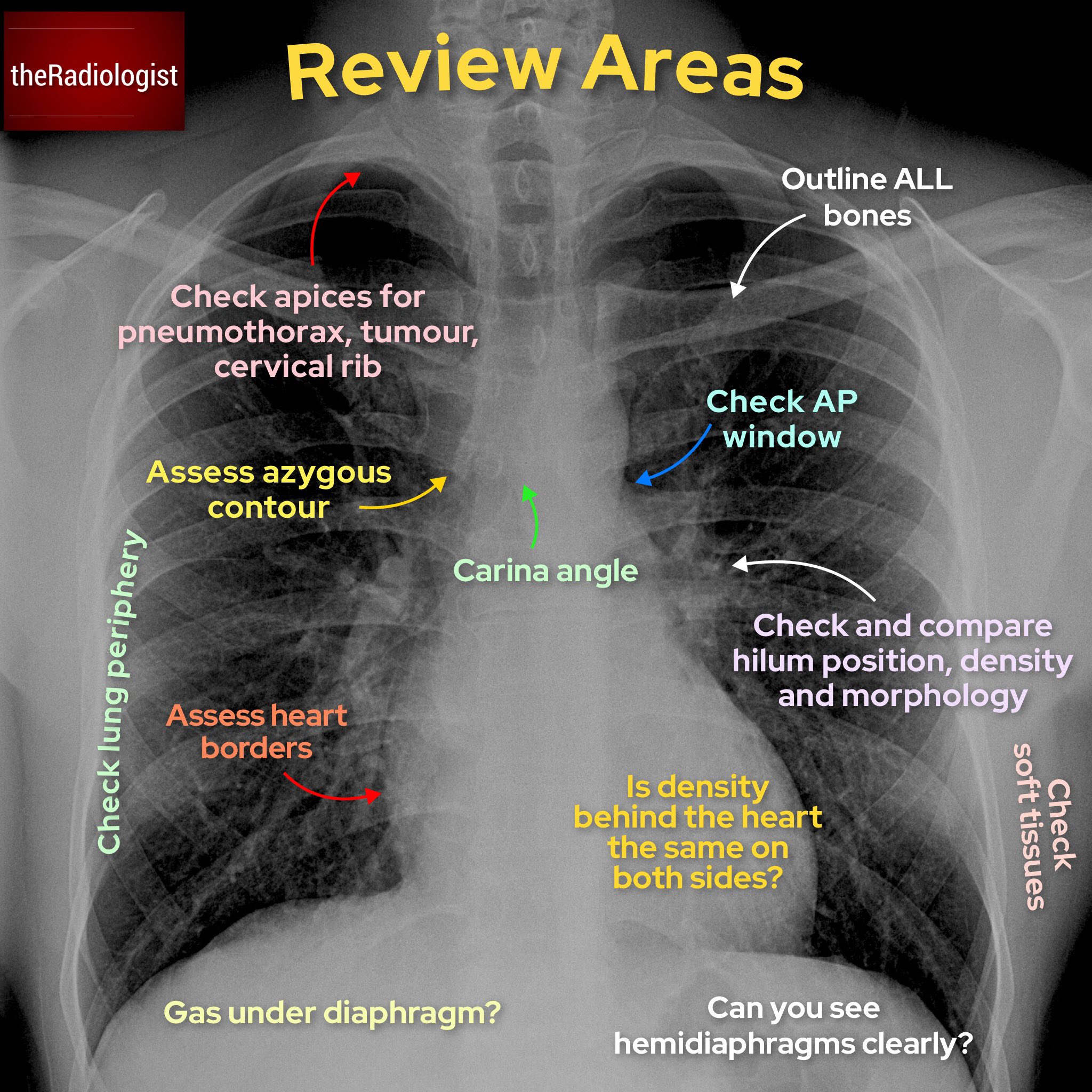 review_areas.jpeg