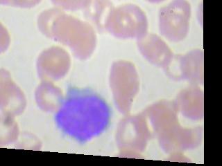 lymphocyte.jpeg