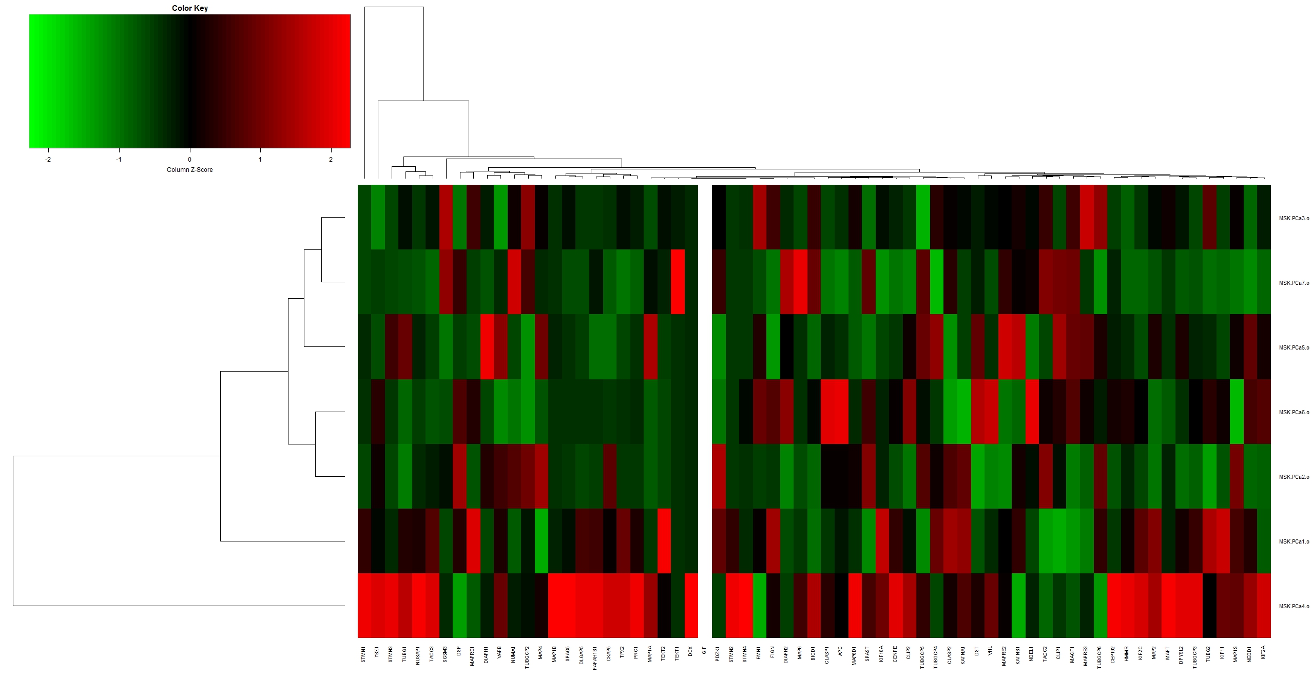 MSK_PC_diff_exp_nor.jpeg