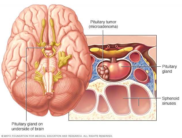 pituitary_image.JPEG