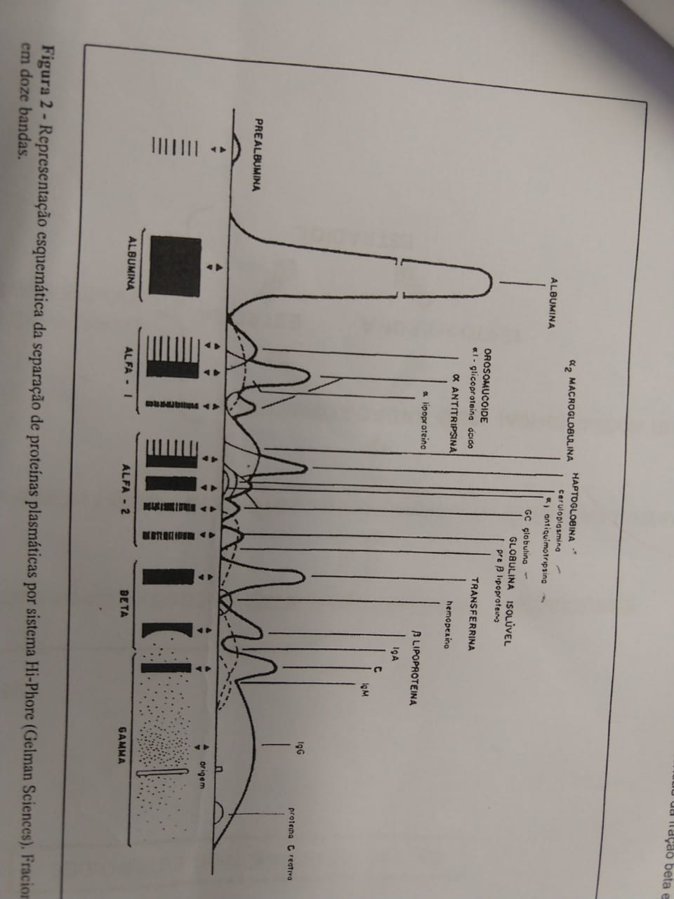 separacao_proteinas_plasmaticas.jpeg